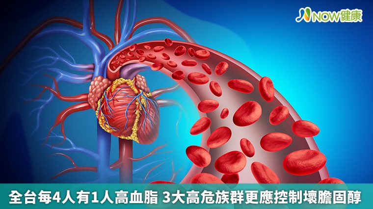 全台每4人有1人高血脂 3大高危族群更應控制壞膽固醇
