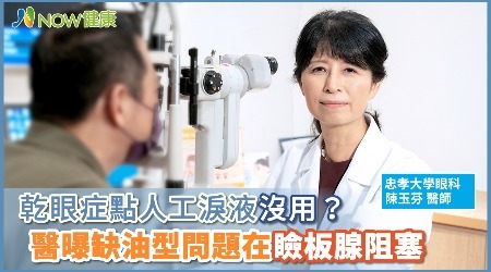 乾眼症點人工淚液沒用？ 醫曝缺油型問題在瞼板腺阻塞