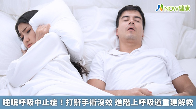 睡眠呼吸中止症！打鼾手術沒效 進階上呼吸道重建解救