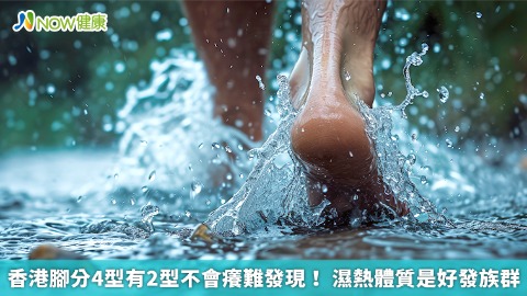 香港腳分4型有2型不會癢難發現！ 濕熱體質是好發族群