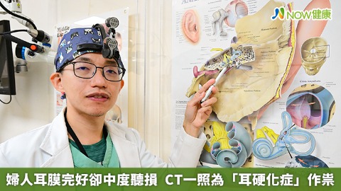 婦人耳膜完好卻中度聽損  CT一照為「耳硬化症」作祟