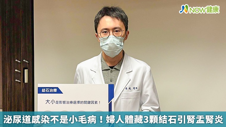 泌尿道感染不是小毛病！婦人體藏3顆結石引腎盂腎炎