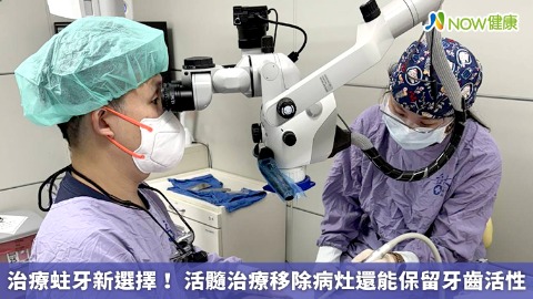 治療蛀牙新選擇！ 活髓治療移除病灶還能保留牙齒活性