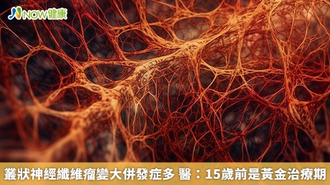 叢狀神經纖維瘤變大併發症多 醫：15歲前是黃金治療期