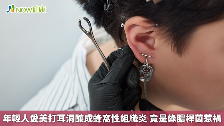 年輕人愛美打耳洞釀成蜂窩性組織炎 竟是綠膿桿菌惹禍