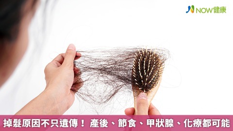掉髮原因不只遺傳！ 產後、節食、甲狀腺、化療都可能