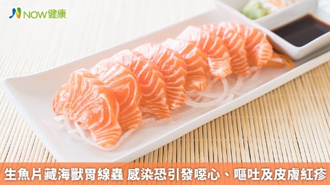 生魚片藏海獸胃線蟲 感染恐引發噁心、嘔吐及皮膚紅疹