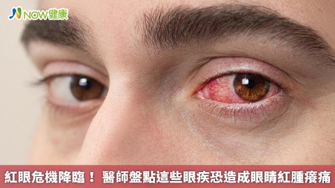 紅眼危機降臨！ 醫師盤點這些眼疾恐造成眼睛紅腫癢痛