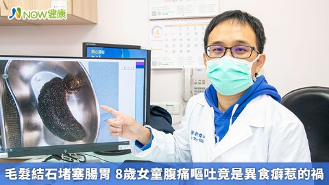 毛髮結石堵塞腸胃 8歲女童腹痛嘔吐竟是異食癖惹的禍