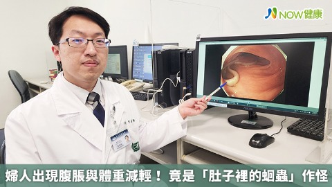 婦人出現腹脹與體重減輕！ 竟是「肚子裡的蛔蟲」作怪