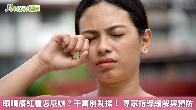 眼睛癢紅腫怎麼辦？千萬別亂揉！ 專家指導緩解與預防