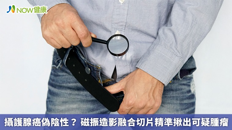 攝護腺癌偽陰性？ 磁振造影融合切片精準揪出可疑腫瘤