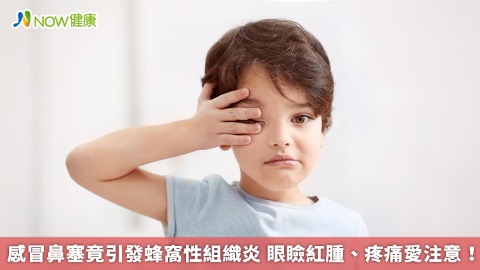 感冒鼻塞竟引發蜂窩性組織炎 眼瞼紅腫、疼痛愛注意！