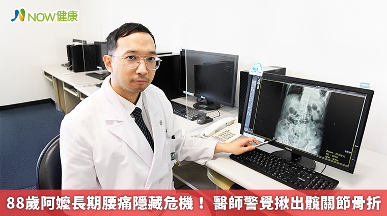 88歲阿嬤長期腰痛隱藏危機！ 醫師警覺揪出髖關節骨折