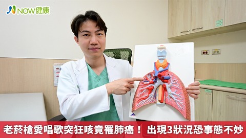 老菸槍愛唱歌突狂咳竟罹肺癌！ 出現3狀況恐事態不妙