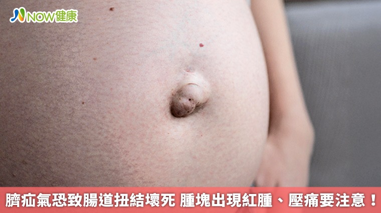 臍疝氣恐致腸道扭結壞死 腫塊出現紅腫、壓痛要注意！