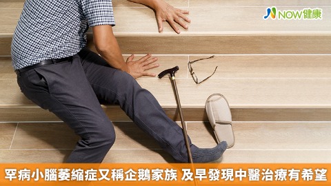 罕病小腦萎縮症又稱企鵝家族 及早發現中醫治療有希望