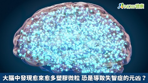 大腦中發現愈來愈多塑膠微粒 恐是導致失智症的元凶？