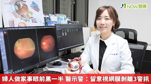 婦人做家事眼前黑一半 醫示警：留意視網膜剝離3警訊
