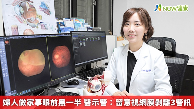 婦人做家事眼前黑一半 醫示警：留意視網膜剝離3警訊