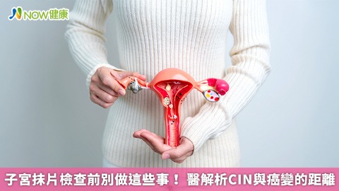 子宮抹片檢查前別做這些事！ 醫解析CIN與癌變的距離