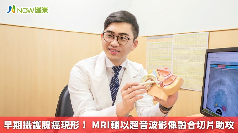 早期攝護腺癌現形！ MRI輔以超音波影像融合切片助攻