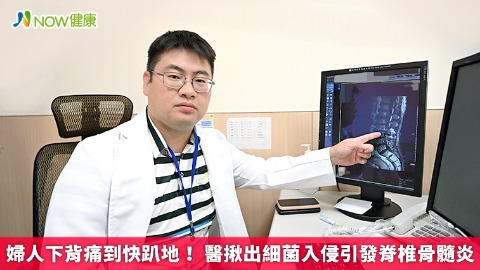 婦人下背痛到快趴地！ 醫揪出細菌入侵引發脊椎骨髓炎