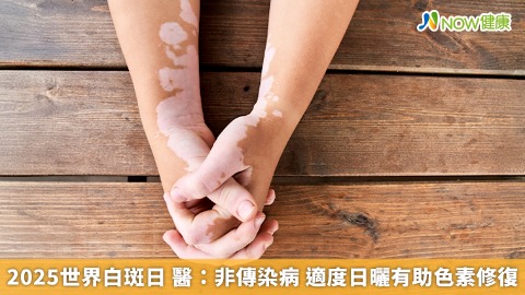 2025世界白斑日 醫：非傳染病 適度日曬有助色素修復