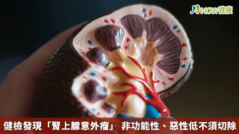 健檢發現「腎上腺意外瘤」 非功能性、惡性低不須切除