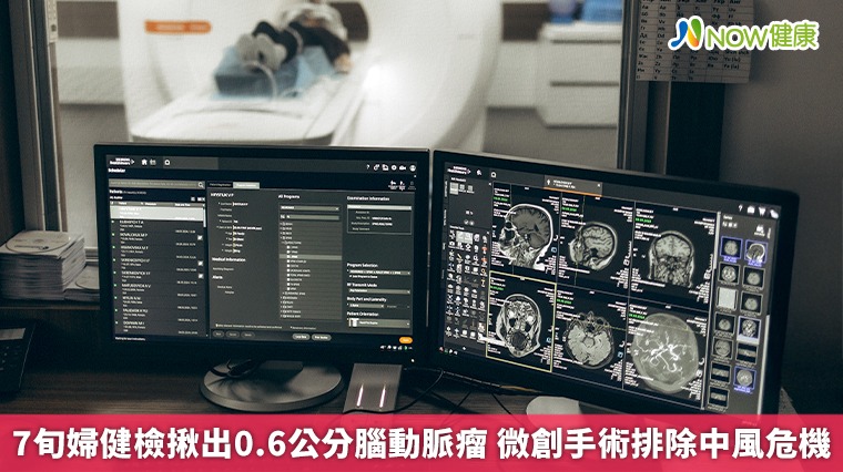 7旬婦健檢揪出0.6公分腦動脈瘤  微創手術排除中風危機