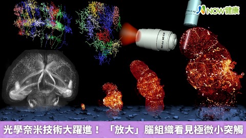 光學奈米技術大躍進！ 「放大」腦組織看見極微小突觸