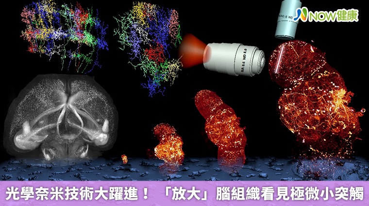 光學奈米技術大躍進！ 「放大」腦組織看見極微小突觸