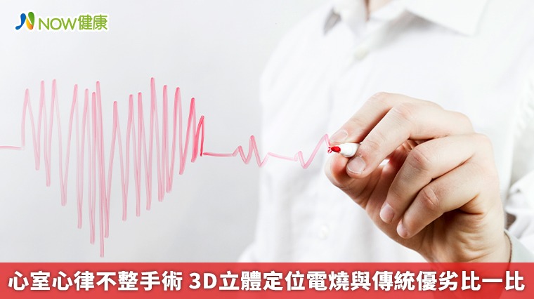 心室心律不整手術 3D立體定位電燒與傳統優劣比一比