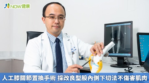 人工膝關節置換手術 採改良型股內側下切法不傷害肌肉