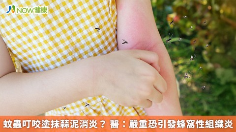 蚊蟲叮咬塗抹蒜泥消炎？ 醫：嚴重恐引發蜂窩性組織炎