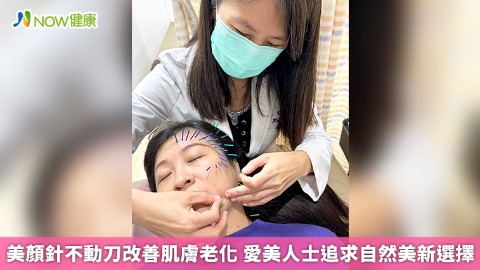 美顏針不動刀改善肌膚老化 愛美人士追求自然美新選擇