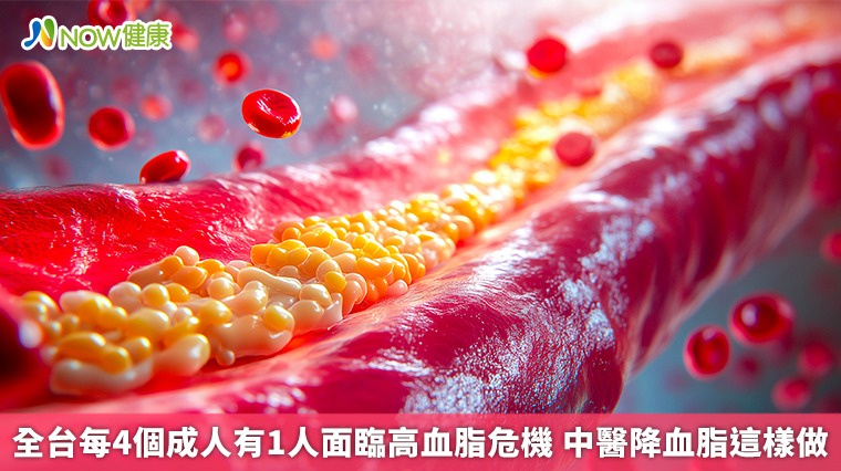 全台每4個成人有1人面臨高血脂危機 中醫降血脂這樣做