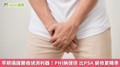 早期攝護腺癌偵測利器！PHI納健保  比PSA 篩檢更精準