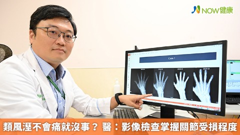 類風溼不會痛就沒事？ 醫：影像檢查掌握關節受損程度