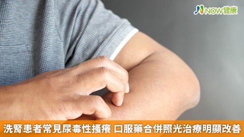洗腎患者常見尿毒性搔癢 口服藥合併照光治療明顯改善