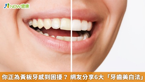 你正為黃板牙感到困擾？ 網友分享6大「牙齒美白法」