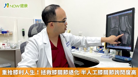 重拾膝利人生！拯救膝關節退化 半人工膝關節詢問度高