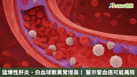 猛爆性肝炎、白血球數異常增高！ 醫示警血癌可能風險