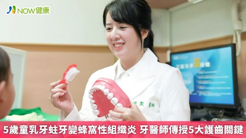 5歲童乳牙蛀牙變蜂窩性組織炎 牙醫師傳授5大護齒關鍵