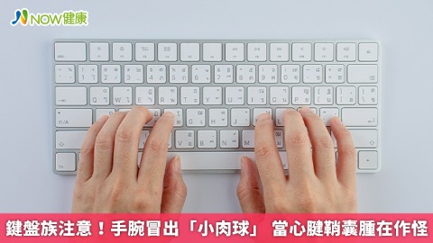 鍵盤族注意！手腕冒出「小肉球」 當心腱鞘囊腫在作怪