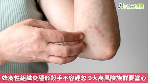 小傷口也要留意。