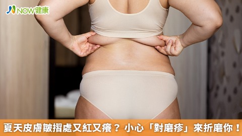 夏天皮膚皺摺處又紅又癢？ 小心「對磨疹」來折磨你！