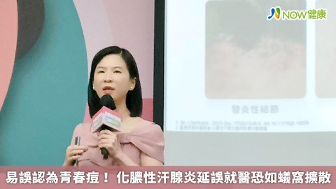易誤認為青春痘！ 化膿性汗腺炎延誤就醫恐如蟻窩擴散
