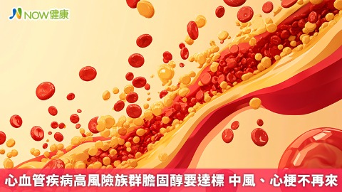 心血管疾病高風險族群膽固醇要達標 中風、心梗不再來