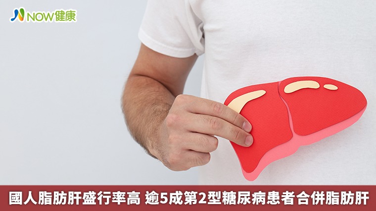 國人脂肪肝盛行率高 逾5成第2型糖尿病患者合併脂肪肝
